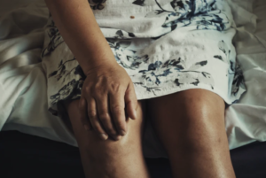 athritis